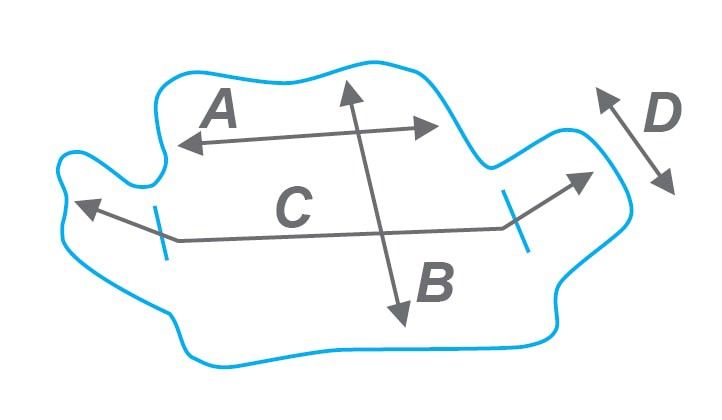Функционально-корригирующий корсет (размер L) STABILO CONFORTABLE PLUS Noel купить в OrtoMir24